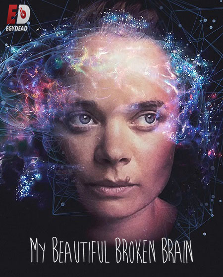 مشاهدة مشاهدة فيلم My Beautiful Broken Brain 2014 مترجم